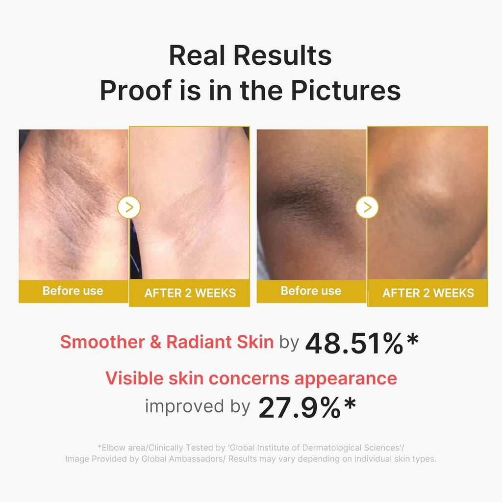Body Peel Shot with Kojic Acid and Turmeric