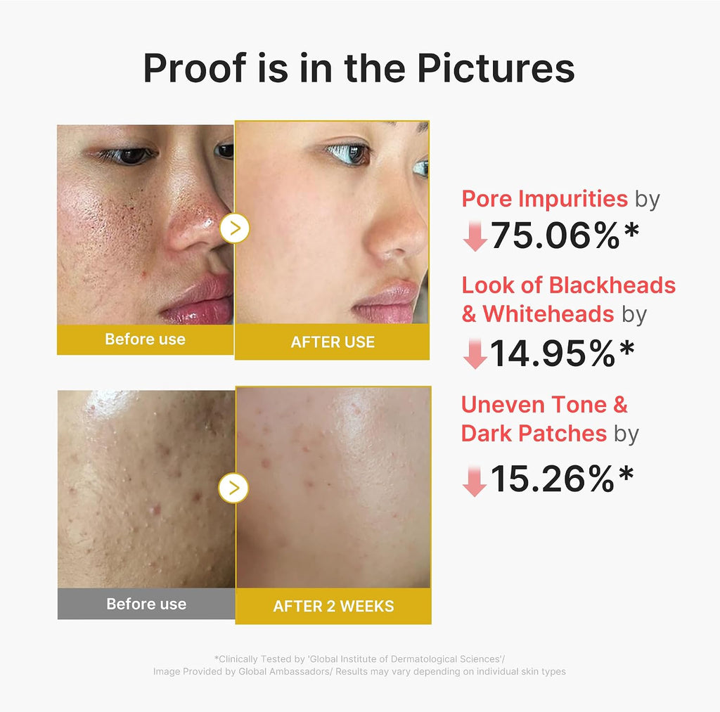 Peel & Wipe Clarifying Duo: Turmeric Peel Shot & Kojic Acid Toner Pads | Gentle Exfoliation & Texture Refining Routine | Ideal for Soothing, Balancing, Smoothing Uneven Skin Tone & Texture