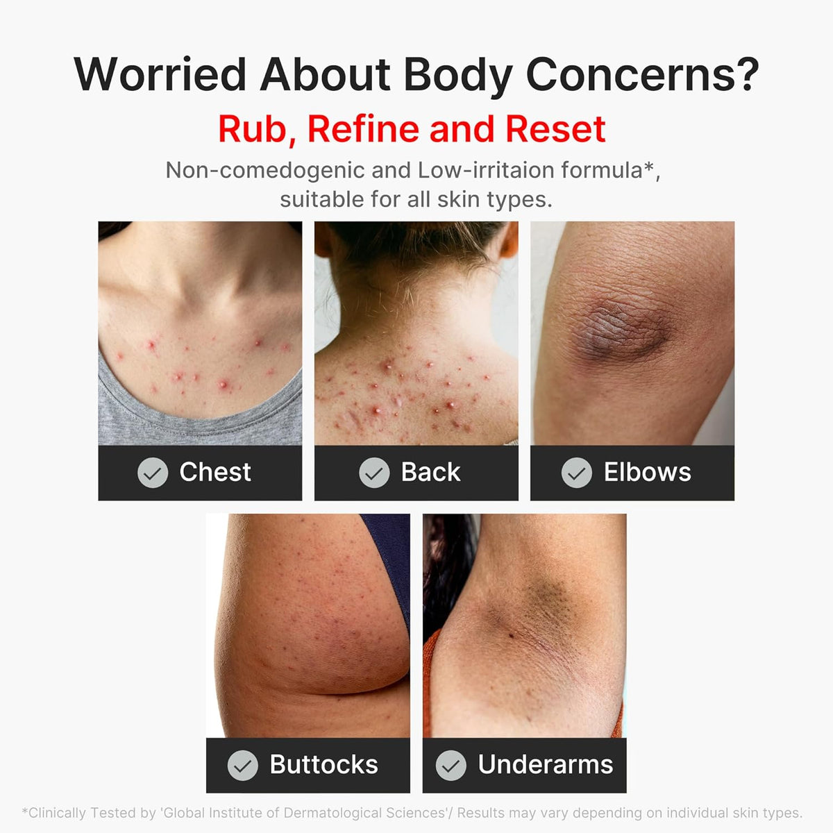 Body Peel Shot with Kojic Acid and Turmeric